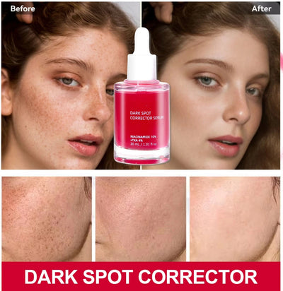 Sérum anti tache, éclaircissant pour le visage.