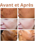 La crème Glutathione Glow chez Gladys Beauty : un soin anti-taches et anti-acné pour une peau éclatante !