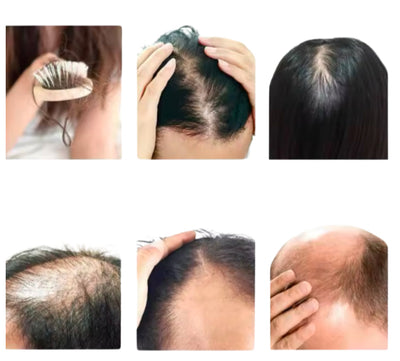 Produits anti-chute !Le secret pour avoir de longs cheveux.Chébé  Ensemble de croissance capillaire Glad’isBeauty.