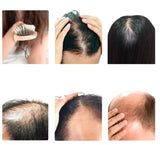 Le secret pour avoir de longs cheveux.Chébé  Ensemble de croissance capillaire Glad’isBeauty.