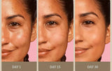 ⸻

CRÈME VISAGE Anti-acné
ÉCLAT & ÉCLAIRCISSANTE
VITAMINE C & E (infusée au glutathion & huile de citron & Curcuma,
Sans hydroquinone
