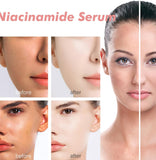 **Anua Peach 70% Niacin Serum**  
Sérum hydratant, éclaircissant, réducteur de pores, illuminateur et anti-rides pour visage terne