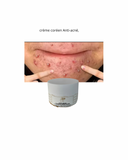 ⸻

CRÈME VISAGE Anti-acné
ÉCLAT & ÉCLAIRCISSANTE
VITAMINE C & E (infusée au glutathion & huile de citron & Curcuma,
Sans hydroquinone