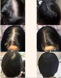 Le secret pour avoir de longs cheveux.Chébé  Ensemble de croissance capillaire Glad’isBeauty.