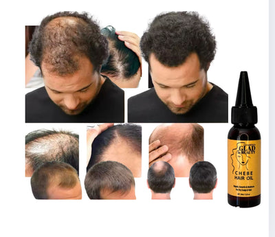 Produits anti-chute !Le secret pour avoir de longs cheveux.Chébé  Ensemble de croissance capillaire Glad’isBeauty.