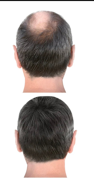 Le secret pour avoir de longs cheveux.Après shampooing à l'oignon rouge