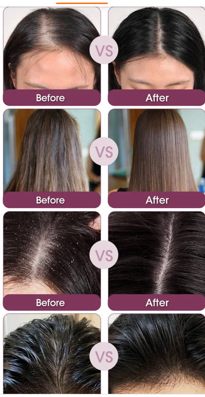 shampoing
Anti-Chute.Le secret pour avoir de longs cheveux.Gamme capillaire  a l’oignon rouge chez Glad's Beauty