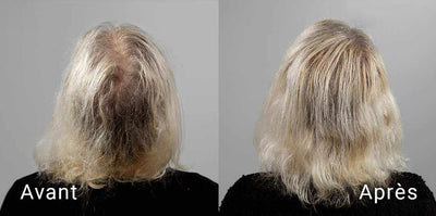 Shampooing  Anti-Chute à l'oignon rouge